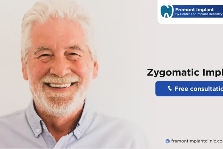 Tips to Reduce Zygomatic Implants Recovery Time